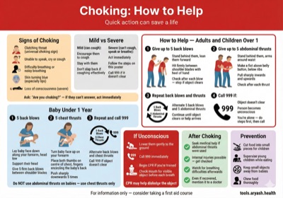 Choking first aid guide preview