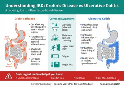 IBD Crohn's vs Ulcerative Colitis infographic preview