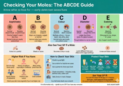 Mole check ABCDE rule preview